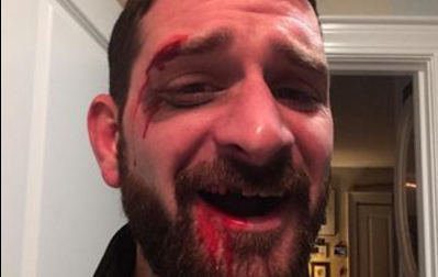 Fan bust his tooth but still wins on Tom Brady’s Uggs hunt